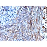 Immunohistochemistry - Anti-Fibronectin Antibody [FN1/3568] (A248584) - Antibodies.com