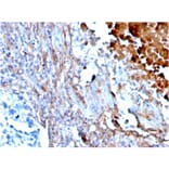 Immunohistochemistry - Anti-Fibronectin Antibody [FN1/3568] (A248584) - Antibodies.com
