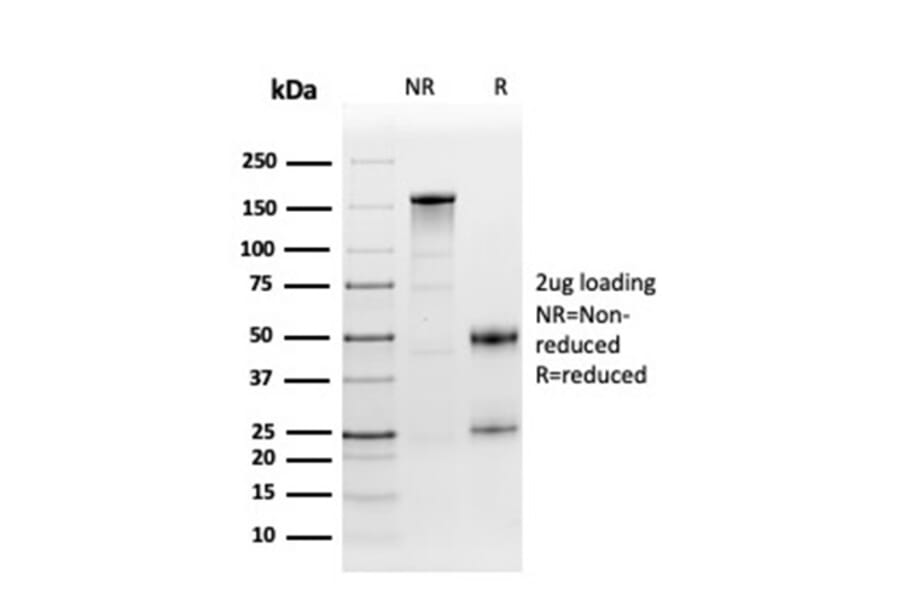 SDS-PAGE - Anti-Fibronectin Antibody [FN1/3568] (A248584) - Antibodies.com