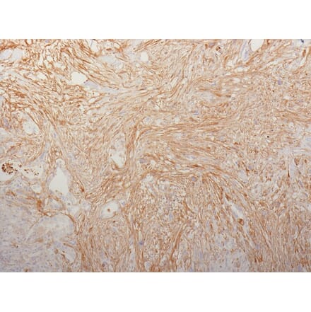 Immunohistochemistry - Anti-Fibronectin Antibody [HFN7.1] (A248584) - Antibodies.com