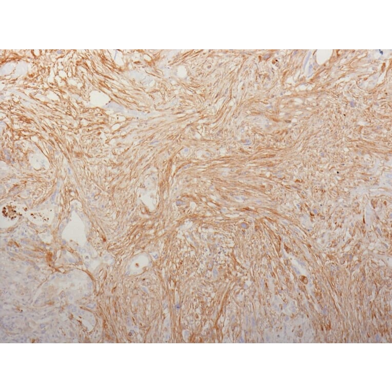 Immunohistochemistry - Anti-Fibronectin Antibody [HFN7.1] (A248584) - Antibodies.com