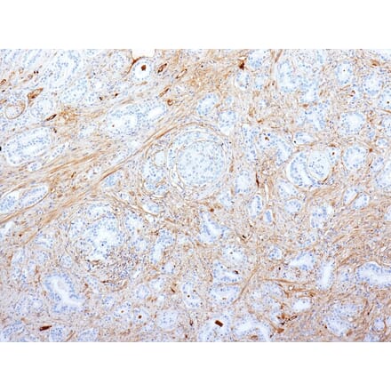 Immunohistochemistry - Anti-Fibronectin Antibody [SPM539] (A248585) - Antibodies.com
