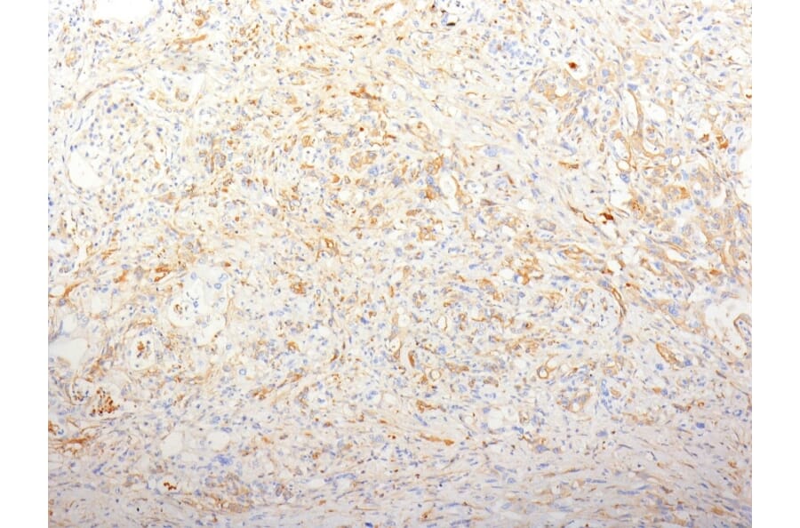 Immunohistochemistry - Anti-Fibronectin Antibody [TV-1] (A248586) - Antibodies.com