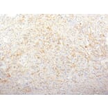 Immunohistochemistry - Anti-Fibronectin Antibody [TV-1] (A248586) - Antibodies.com