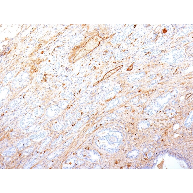 Immunohistochemistry - Anti-Fibronectin Antibody [SPM246] (A248587) - Antibodies.com