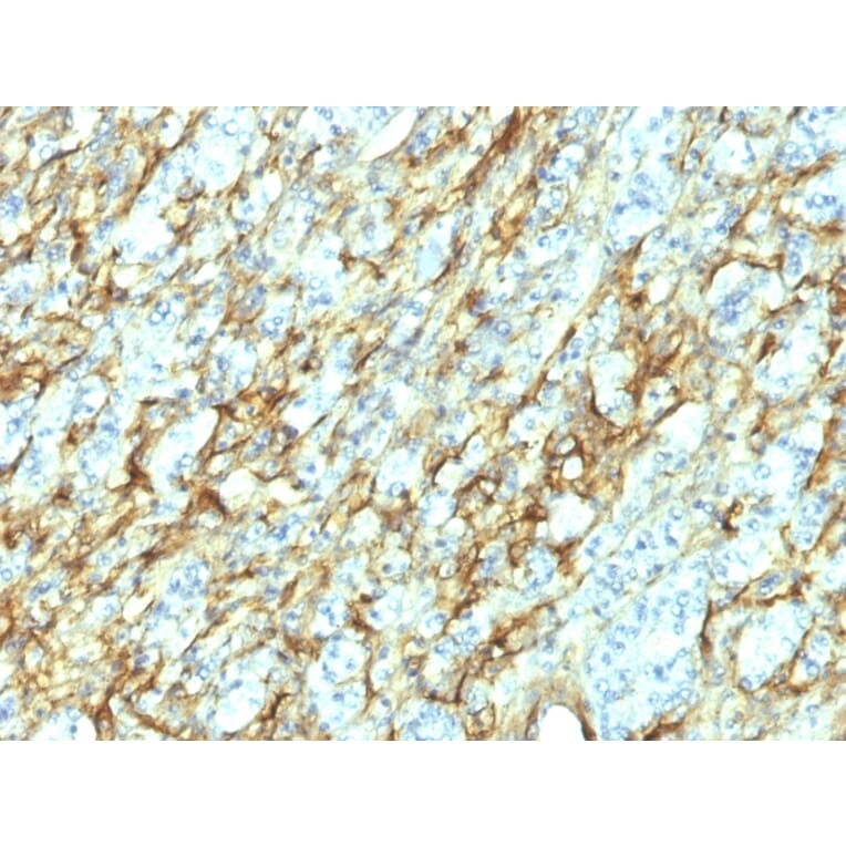 Immunohistochemistry - Anti-Fibronectin Antibody [568] (A248588) - Antibodies.com