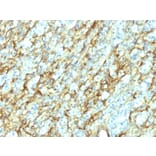 Immunohistochemistry - Anti-Fibronectin Antibody [568] (A248588) - Antibodies.com