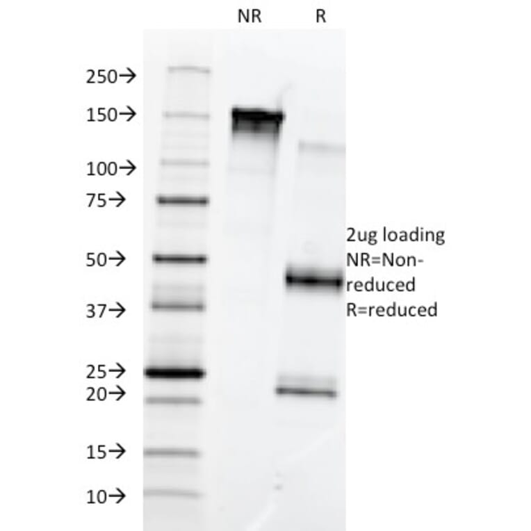 SDS-PAGE - Anti-Fibronectin Antibody [568] (A248589) - Antibodies.com