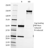 SDS-PAGE - Anti-Fibronectin Antibody [616] (A248590) - Antibodies.com