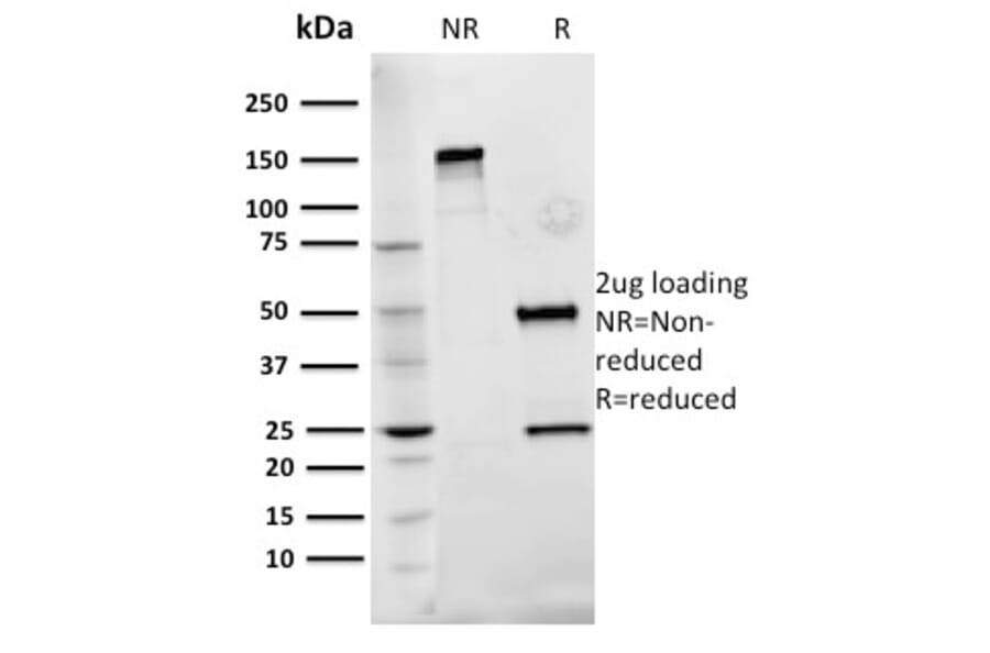 SDS-PAGE - Anti-Fibronectin Antibody [Fn-3] (A248590) - Antibodies.com