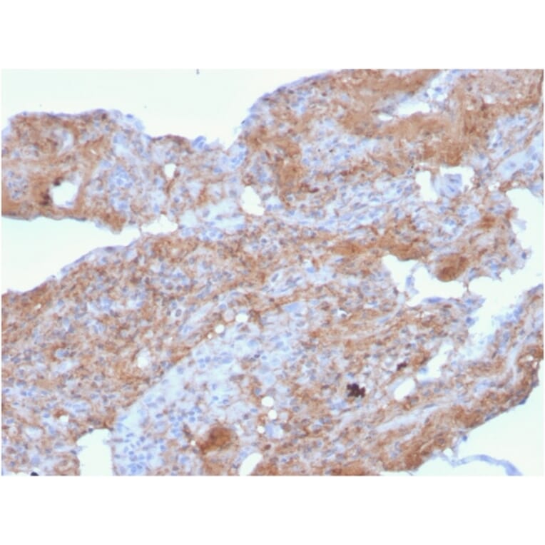 Immunohistochemistry - Anti-Fibronectin Antibody [FN1/2948] (A248592) - Antibodies.com