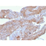 Immunohistochemistry - Anti-Fibronectin Antibody [FN1/2948] (A248592) - Antibodies.com