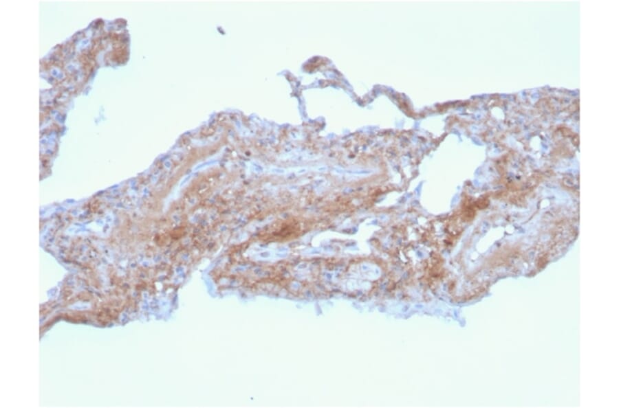 Immunohistochemistry - Anti-Fibronectin Antibody [FN1/2948] (A248592) - Antibodies.com