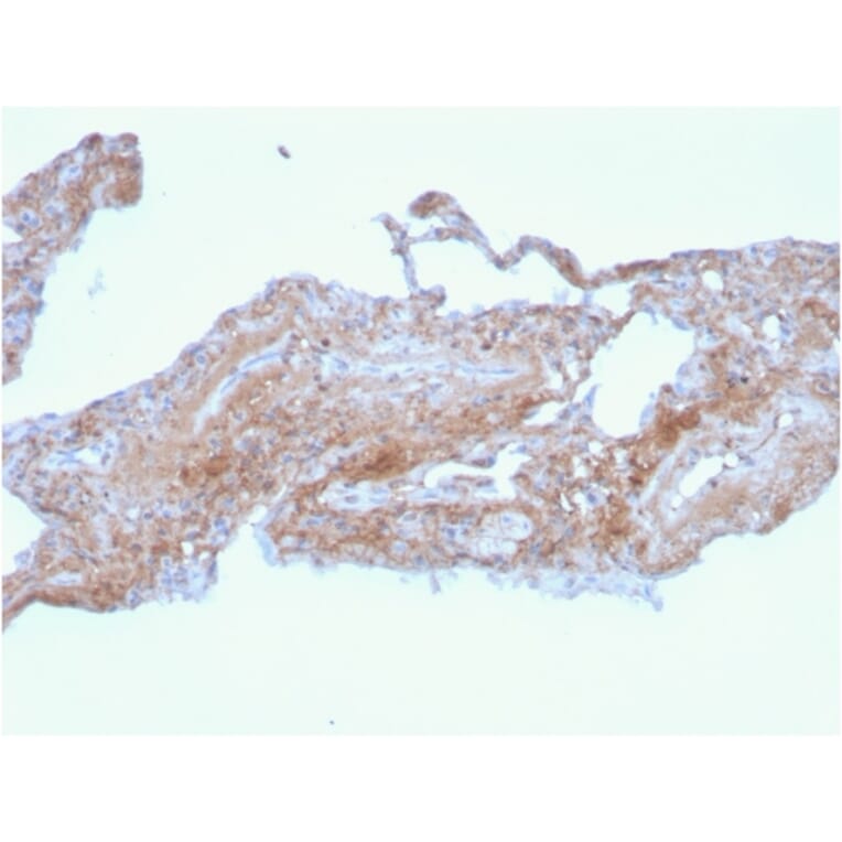 Immunohistochemistry - Anti-Fibronectin Antibody [FN1/2948] (A248592) - Antibodies.com