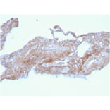 Immunohistochemistry - Anti-Fibronectin Antibody [FN1/2948] (A248592) - Antibodies.com