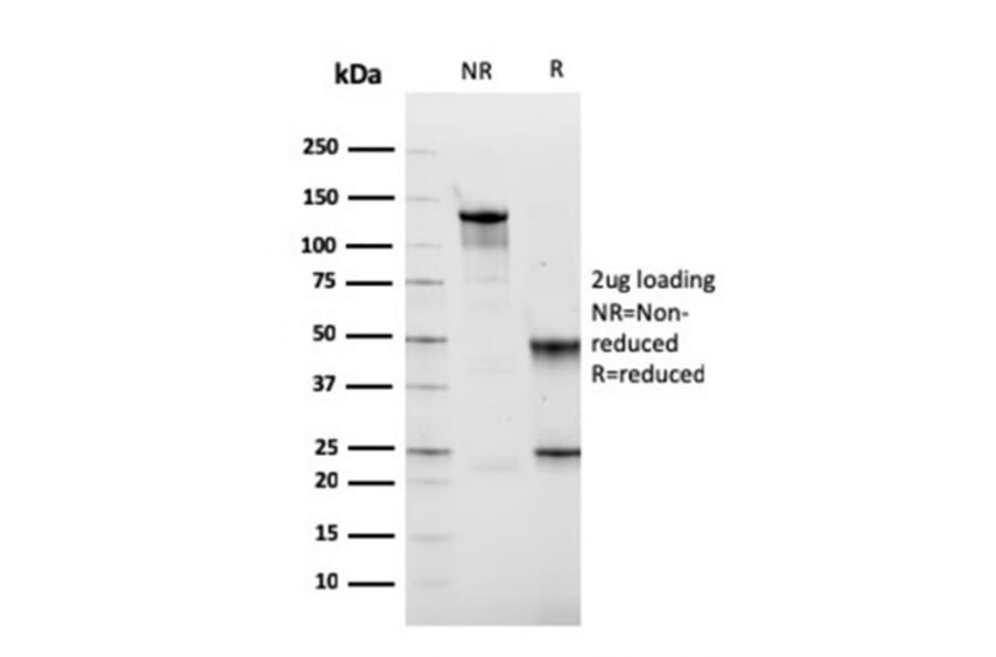SDS-PAGE - Anti-Fibronectin Antibody [FN1/2949] (A248593) - Antibodies.com
