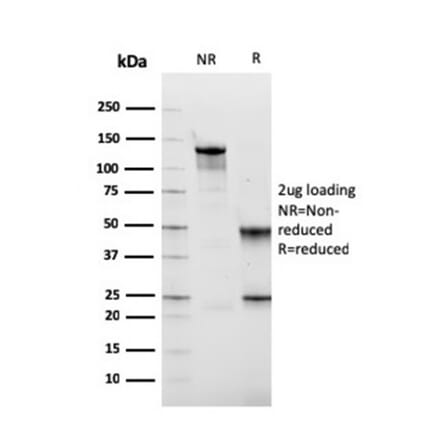 SDS-PAGE - Anti-Fibronectin Antibody [FN1/2949] (A248593) - Antibodies.com