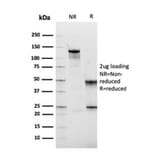 SDS-PAGE - Anti-Fibronectin Antibody [FN1/2949] (A248593) - Antibodies.com