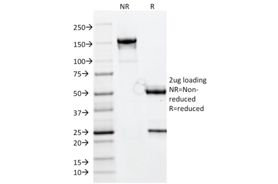 SDS-PAGE - Anti-CELA3B Antibody [CELA3B/1811] (A248593) - Antibodies.com