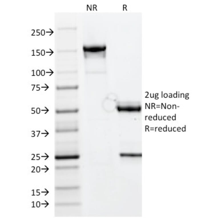 SDS-PAGE - Anti-CELA3B Antibody [CELA3B/1811] (A248593) - Antibodies.com