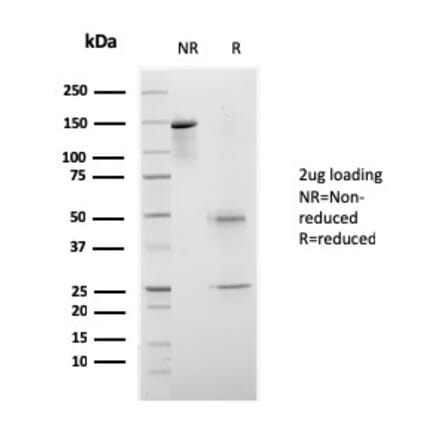 SDS-PAGE - Anti-CELA3B Antibody [rCELA3B/1811] (A248595) - Antibodies.com