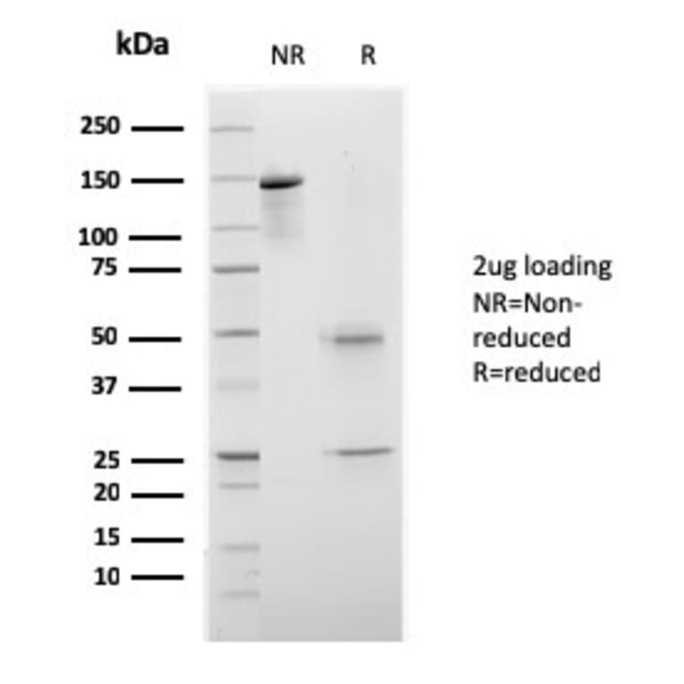 SDS-PAGE - Anti-CELA3B Antibody [rCELA3B/1811] (A248595) - Antibodies.com