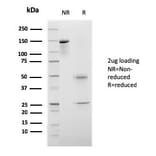 SDS-PAGE - Anti-CELA3B Antibody [rCELA3B/1811] (A248595) - Antibodies.com