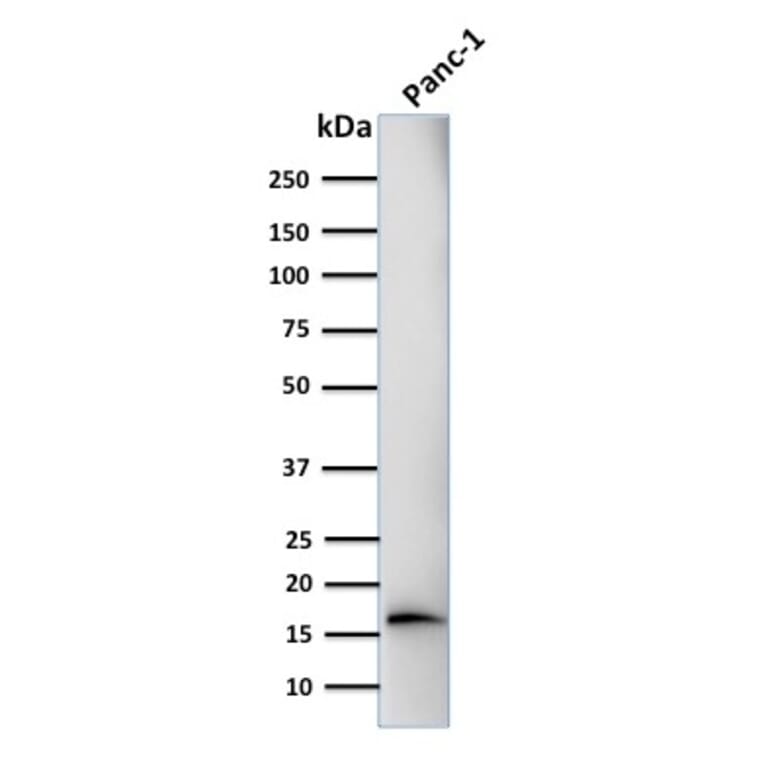 Western Blot - Anti-CELA3B Antibody [CELA3B/1218] (A248596) - Antibodies.com