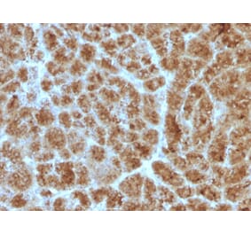 Immunohistochemistry - Anti-CELA3B Antibody [CELA3B/1257] (A248596) - Antibodies.com
