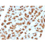 Immunohistochemistry - Anti-CELA3B Antibody [CELA3B/1257] (A248597) - Antibodies.com