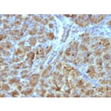 Immunohistochemistry - Anti-CELA3B Antibody [CELA3B/1257] (A248597) - Antibodies.com