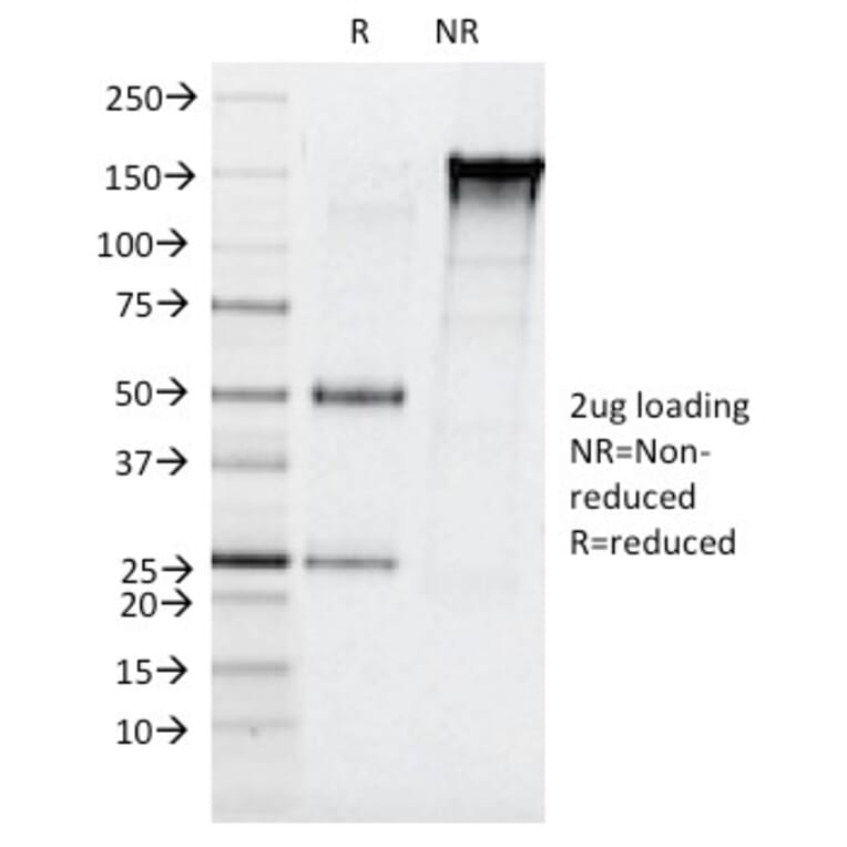 SDS-PAGE - Anti-CELA3B Antibody [CELA3B/1257] (A248597) - Antibodies.com