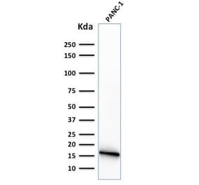 Western Blot - Anti-CELA3B Antibody [CELA3B/1374] (A248598) - Antibodies.com