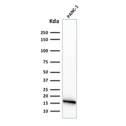 Western Blot - Anti-CELA3B Antibody [CELA3B/1374] (A248598) - Antibodies.com