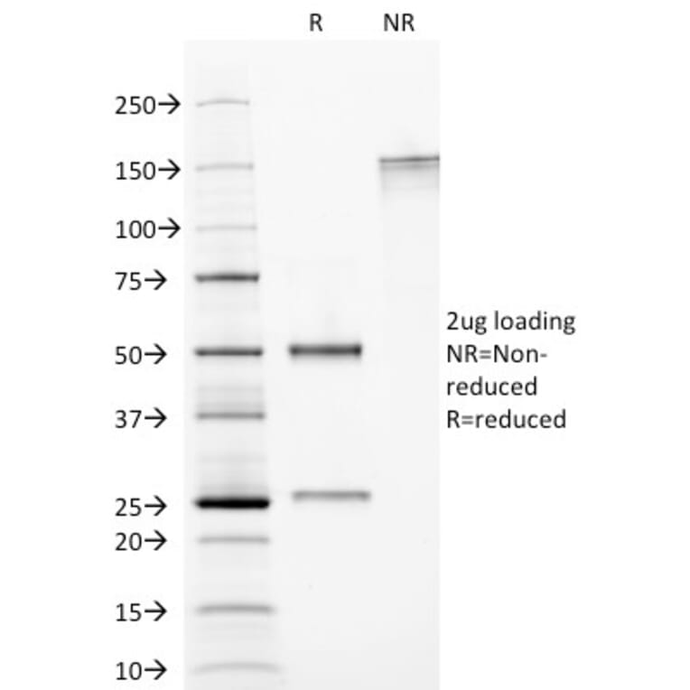 SDS-PAGE - Anti-CELA3B Antibody [CELA3B/1374] (A248597) - Antibodies.com