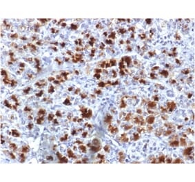 Immunohistochemistry - Anti-CELA3B Antibody [CELA3B/1757] (A248599) - Antibodies.com