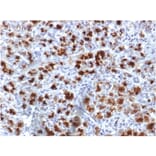 Immunohistochemistry - Anti-CELA3B Antibody [CELA3B/1757] (A248599) - Antibodies.com