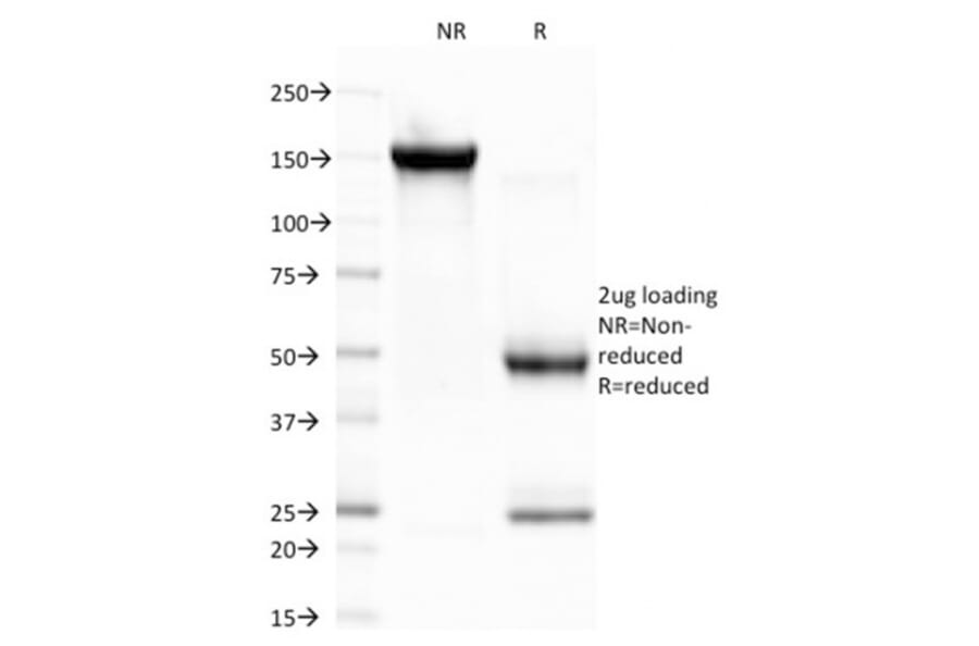 SDS-PAGE - Anti-CELA3B Antibody [CELA3B/1757] (A248599) - Antibodies.com