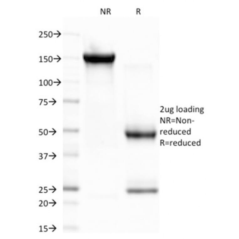 SDS-PAGE - Anti-CELA3B Antibody [CELA3B/1757] (A248599) - Antibodies.com