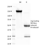 SDS-PAGE - Anti-CELA3B Antibody [CELA3B/1757] (A248599) - Antibodies.com