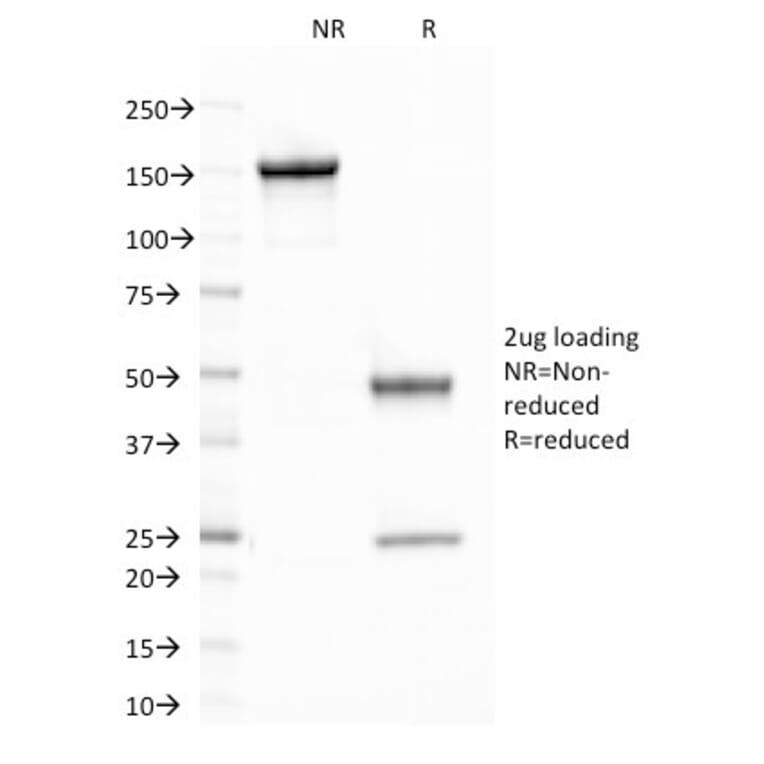 SDS-PAGE - Anti-CELA3B Antibody [CELA3B/1758] (A248599) - Antibodies.com