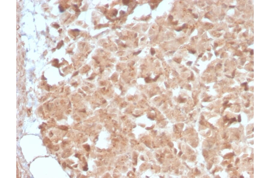 Immunohistochemistry - Anti-CELA3B Antibody [CELA3B/2809R] (A248600) - Antibodies.com