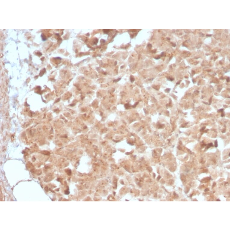 Immunohistochemistry - Anti-CELA3B Antibody [CELA3B/2809R] (A248600) - Antibodies.com