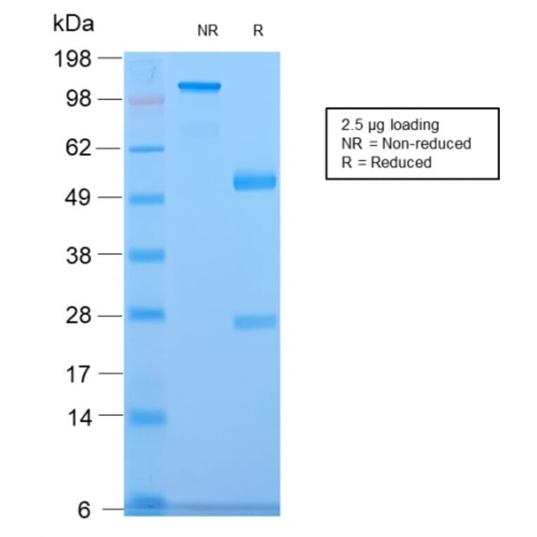 SDS-PAGE - Anti-CELA3B Antibody [CELA3B/2809R] (A248601) - Antibodies.com