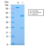 SDS-PAGE - Anti-CELA3B Antibody [CELA3B/2809R] (A248601) - Antibodies.com