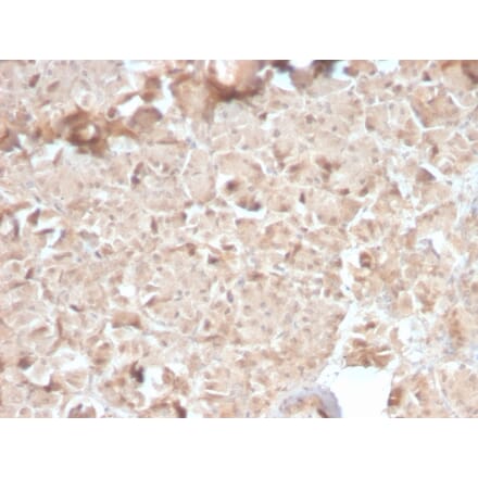 Immunohistochemistry - Anti-CELA3B Antibody [CELA3B/2810R] (A248601) - Antibodies.com