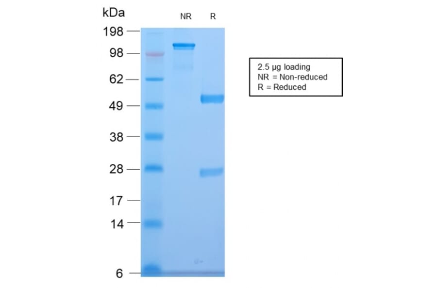 SDS-PAGE - Anti-CELA3B Antibody [CELA3B/2810R] (A248602) - Antibodies.com