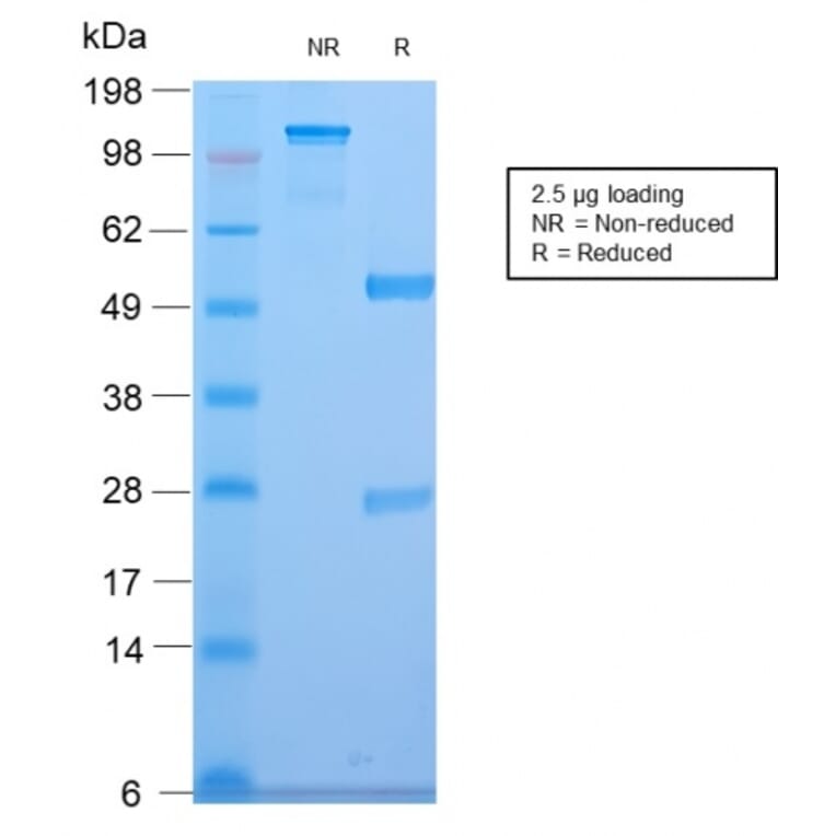 SDS-PAGE - Anti-CELA3B Antibody [CELA3B/2810R] (A248602) - Antibodies.com