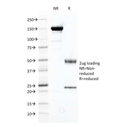 SDS-PAGE - Anti-PSMA Antibody [FOLH1/2121] (A248602) - Antibodies.com