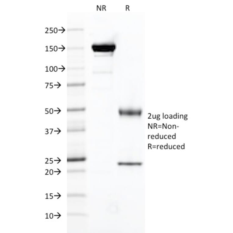 SDS-PAGE - Anti-PSMA Antibody [FOLH1/2121] (A248602) - Antibodies.com
